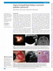 Research paper thumbnail of Atypical histopathology findings in presumed epibulbar cysticercosis