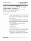 Research paper thumbnail of Image reconstruction of mMR PET data using the open source software STIR