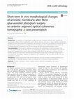 Research paper thumbnail of Trends of Cholecystectomies for Presumed Biliary Dyskinesia in Children in the United States