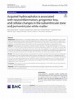 Research paper thumbnail of Acquired hydrocephalus is associated with neuroinflammation, progenitor loss, and cellular changes in the subventricular zone and periventricular white matter