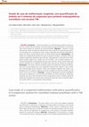 Research paper thumbnail of Case study of a congenital malformation with piston quantification in 4 suspension systems for transtibial modular prostheses with a TSB socket