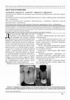 Research paper thumbnail of Диастематомиелия (клинический случай)