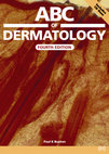 Research paper thumbnail of ABC of Dermatology