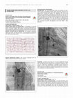 Research paper thumbnail of TCTAP C-217 Danger in Plain Sight: Ostial Left Anterior Descending Artery Injury During Ablation of Left Ventricular Summit Premature Ventricular Complex