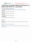 Research paper thumbnail of Arterial and vein related catheters thrombosis in a patient with COVID-19 : a case report