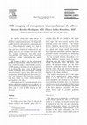 Research paper thumbnail of MR imaging of entrapment neuropathies at the elbow