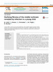 Research paper thumbnail of Ossifying fibroma of the middle turbinate revealed by infection in a young child