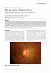 Research paper thumbnail of Optic disc oedema: a diagnostic dilemma