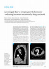 Research paper thumbnail of Acromegaly caused by lung carcinoid with ectopic GHRH secretion