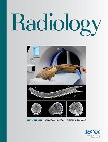 Research paper thumbnail of CT-based Age Estimation of a Mammoth Tusk