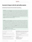 Research paper thumbnail of Assessment of changes in smile after rapid maxillary expansion