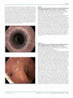 Research paper thumbnail of Mo1548 Safety and Efficacy of a Through-the-Scope Esophageal Stent for Non- Sophageal Indications: a Single Center Case Series