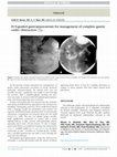 Research paper thumbnail of EUS-guided gastrojejunostomy for management of complete gastric outlet obstruction