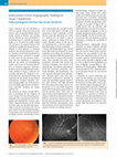 Research paper thumbnail of Indocyanine-Green Angiography Findings in Susac's Syndrome