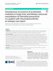 Research paper thumbnail of Simultaneous occurrence of accelerated nodulosis in lungs, liver, and kidneys, and acute exacerbation of interstitial pneumonia in a patient with rheumatoid arthritis: an autopsy case report