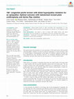 Research paper thumbnail of 180° congenital penile torsion with distal hypospadias mistaken for an epispadias: Optimal outcome with tubularized incised plate urethroplasty and dartos flap rotation