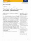 Research paper thumbnail of Craniofacial and intraoral phenotype of Robinow syndrome forms