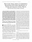 Research paper thumbnail of Microscopic image analysis for quantitative measurement and feature identification of normal and cancerous colonic mucosa