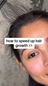 credit: @dorocubillo  🌱 Hey, gorgeous! Feeling a bit impatient with your hair growth journey? 🌸 Trust me, we've all been there. It's like watching grass grow, right? But fear not, because I've got some juicy hair care secrets just for you! 🚀 Dive into our latest video where we spill the tea on the best tips for promoting hair growth. Say goodbye to lackluster locks and hello to luscious, Rapunzel-worthy tresses! 💁‍♀️✨ Whether you're dreaming of long mermaid waves or just want to boost your mane's vitality, we've got your back. Ready to unlock the secrets to your dream hair? Let's do this! 💇‍♀️💖 #HairCareTips #HairGrowth #HairGoals