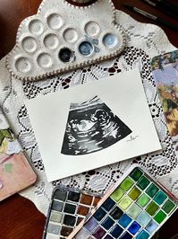 "Heirloom Watercolor Ultrasound Painting  5x7 Paper A hand painted ultrasound photo is the perfect heirloom gift for yourself or a Mama-to-be in your life! It is a beautiful way of honoring life in the womb and preserving the memory for years to come. 😊  Instructions:  1. Choose which colorway you would like the ultrasound to be painted under the \"primary color\" tab.  2. Submit a photo of your ultrasound upon placing your order"