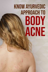 READ MORE by clicking below👇 Ayurveda views acne as a manifestation of an imbalance in the body. This condition resembles Yauvanapidika (acne). According to Ayurveda, acne is caused by an accumulation of toxins (ama) in the body, which can clog the skin pores, leading to inflammation and developing pimples.