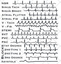 EKG Strip file for the cardiac lover in your life.  This is a DIGITAL SVG FILE ONLY, no physical item will be sent.  - Once you have completed your purchase, a link to download will be sent to the e-mail account registered to your Etsy account. - Design can be downloaded and cut with any silhouette, cricut, or other scan and cut. - Please do not resell or share the digital files. ⚠️ - Digital files CANNOT BE REFUNDED. If you have any problems, concerns and queries with your downloads, feel free to reach out and send a message. To purchase a tumbler with this design you can find a link in my shop! Please let me know if you have any problems or questions.