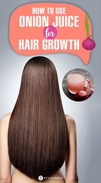 How To Use Onion Juice For Hair Growth: Using growth-stimulating ingredients like onion can help boost the rate at which your hair grows while also adding volume. In the following article, we’ve compiled a list of the 12 ways to use onions to boost hair growth. #Hair #HairCare #HairGrowth