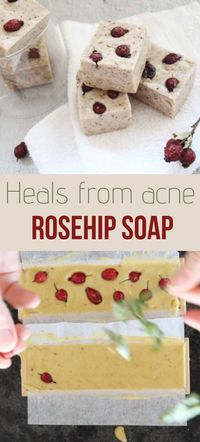 This gentle and smooth homemade rosehip soap is unique with its triple action of rosehips. Enhanced with rosehip seed oil, rosehip powder and dried rosehips, this easy to make soap moisturizes your skin and heal it from bruises, acne and wrinkles. It might also help to heal the skin from dermatitis or eczema.