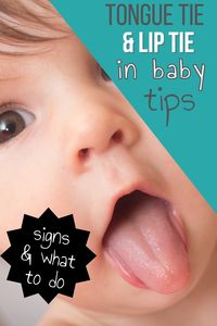 If your baby is struggling with eating, there might be a tongue tie or lip tie. This can cause the baby to struggle with eating whether breastfeeding or bottle feeding. Find out the signs in baby, signs in mom, and how to correct it.