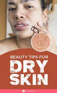 10 Top Tips For Dry Skin: No individual would prefer to keep themselves in a state where the skin is dry and feeling stretchy. So what do you think you can do?Fret not! Here are a few great and natural dry skin care tips that will help you relieve your parched to thus offer you soft, shiny and hydrated skin. #Skin #SkinCare #DrySkin #SkinCareTips