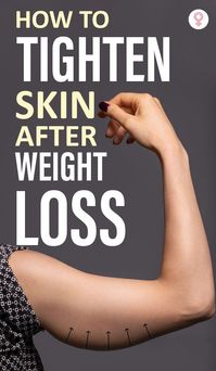 How To Tighten Skin After Weight Loss: You have to be strong physically and mentally to achieve the targeted weight. But if your skin has become loose in the process, worry not. There are ways to tighten skin after weight loss. Your skin may sag and lose elasticity during rapid weight loss as it doesn’t get enough time for its shrinkage. However, the right practices can help.