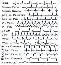 EKG Strip file for the cardiac lover in your life.  This is a DIGITAL SVG FILE ONLY, no physical item will be sent.  - Once you have completed your purchase, a link to download will be sent to the e-mail account registered to your Etsy account. - Design can be downloaded and cut with any silhouette, cricut, or other scan and cut. - Please do not resell or share the digital files. ⚠️ - Digital files CANNOT BE REFUNDED. If you have any problems, concerns and queries with your downloads, feel free