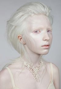 This gorgeous model was photographed at 16 years old by the talented photographer Danil Golovkin. At first glance, she looks like a porcelain doll, but in reality, she has albinism, a rare genetic disorder in which people who are affected by it lack pigment in their eyes, hair, and skin. The name of this model is Nastya Kumarova and she has a very successful modeling career thanks to her magnificent look.