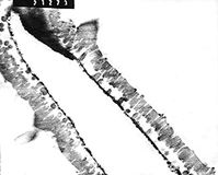 Ancient Eocene palm fossil pollen thin section. Protoarecoidea buchananensis Feldman TEM wall ultrastructure X 8,500 isolated, prepared, cut & photographed by Gwen. Thickening near monosulcate aperture can be seen here, upper corner. Note dense microchannels perforating the tectum. Spines borne on top of tectum (roof-layer) and very thin foot layer. B273a