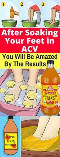 After Soaking Your Feet in Apple Cider Vinegar,You Will Be Amazed By The Results