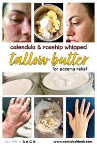 Calendula & Rosehip Whipped Tallow Butter for Eczema Relief - Now Take It Back