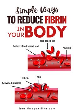 Platelet-activating factor, also known as PAF, PAF-acether or AGEPC (acetyl-glyceryl-ether-phosphorylcholine), is a potent phospholipid activator and mediator of many leukocyte functions Body Inflammation, The Human Body, Diet Meal Plans, Health And Fitness Tips, Health Facts, Blood Vessels, Home Remedies, Fitness Tips, Disease