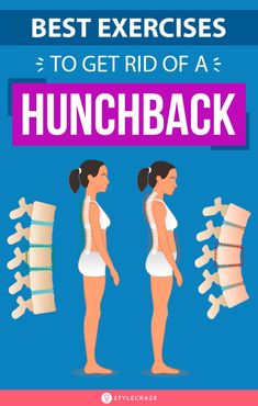 the best exercises to get rid of a hunchback info graphic by tycobase