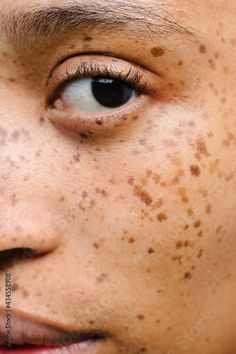 Stock Image: Close up portrait of girl with freckles Face With Freckles, Zoomed In Face, Close Up Photography Face Black Women, Woman With Freckles, Clear Skin With Freckles Aethstetic, Freckle Portrait Photography, Freckle Photography, Freckles Girl, Freckle Face