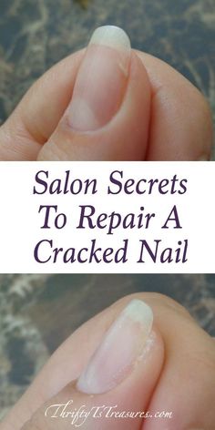 Broken Nails, Nail Repair, Hair Hoco, Homecoming Hair, Can Diy, Nail Health