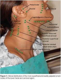 Lymph Node, Kedokteran Gigi, Dental Hygiene School, Dental Anatomy, Basic Anatomy And Physiology, Human Body Anatomy, Medical School Essentials, Muscle Anatomy