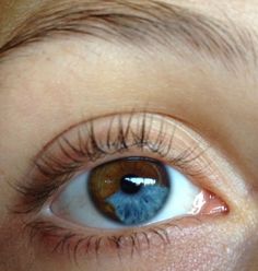 Hetrochormia Eyes Boy, Central Hetrochormia Eyes, Green And Blue Eyes Aesthetic, Green Eyes Astethic, Sectoral Heterochromia, Ocean Blue Eyes Aesthetic, Blue And Green Heterochromia Eyes, Blue And Yellow Eyes Heterochromia, Heterochromia Eyes