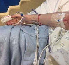 a person in a hospital bed with an oxygen tube attached to their arm and hand