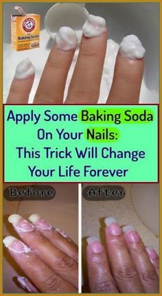 Rub Some Baking Soda On Your Nails And Watch What Happens? This Trick Will Change Your Life Baking Soda Health, Baking Soda Shampoo, How To Grow Nails, Nail Health, Healthy Nails, Beauty Recipe, Health And Beauty Tips, Beauty Treatments, Change Your Life