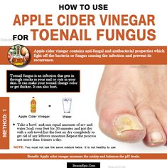 How to Prepare an Apple Cider Vinegar for Toenail Fungus? Acv Benefits, Apple Cider Vinegar Warts, Feet Soak, Apple Cider Vinegar Foot Soak, Apple Cider Vinegar Acne, Toenail Fungus Remedies