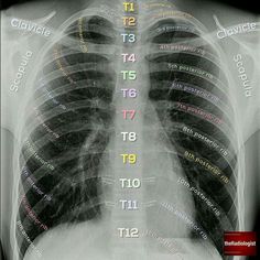 an x - ray shows the chest and ribs with words written all over it in different languages