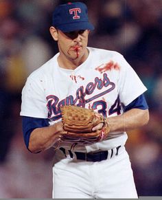 a baseball player holding a catchers mitt with blood on it's face