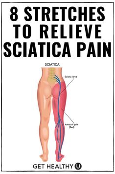 Sciatica Nerve Stretches, Stretch Sciatic Nerve, Relief For Sciatic Nerve Pain, How To Stretch Sciatic Nerve, Yoga Poses For Sciatica Pain, Sciatica Nerve Pain Relief, Sciatic Nerve Relief Left Leg, Sciatica Nerve Stretch, Sciatica Pain Stretches