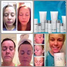 Herbalife Skin Care Products, Herbalife Pictures, Herbalife Advertising, Herbalife Flyers, Herbalife Results, Education Video, Herbalife Distributor