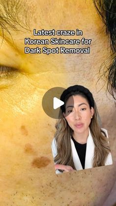 Remove Dark Spots, Korean Skincare, Dark Spots, Skin Care, Skin, Beauty